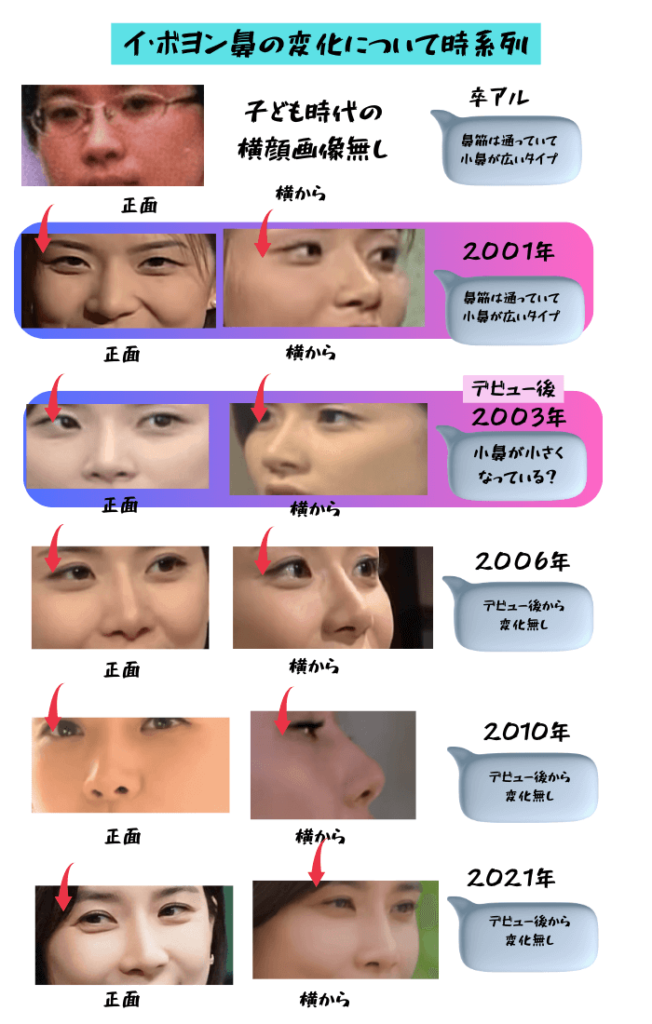 韓国女優イ・ボヨンの卒アルから2021年42歳までの鼻の変化について画像で時系列検証したもの。左側は正面からの鼻の画像。右側は横からの鼻の画像。2001年まで小鼻が広かったが、デビュー後の2003年には小鼻が小さくなっている。