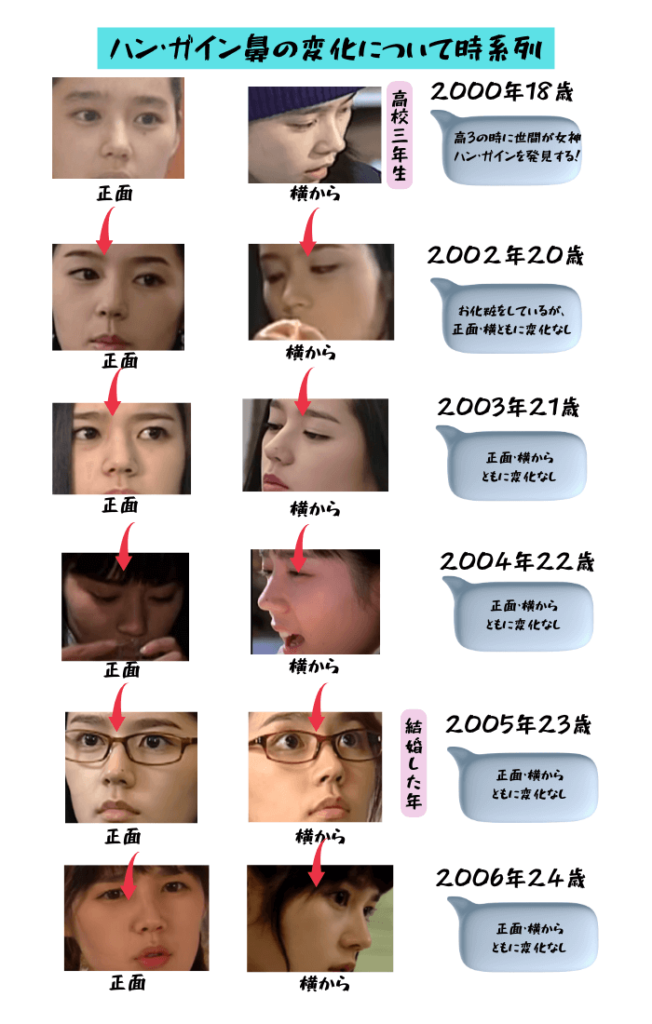 韓国女優ハン・ガインの鼻の変化について検証画像
以下全12枚の画像

2000年18歳高校生（正面からと横から）
2002年20歳（正面からと横から）
2003年21歳（正面からと横から）
2004年22歳（正面からと横から）
2005年23歳（正面からと横から）
2006年24歳（正面からと横から）
