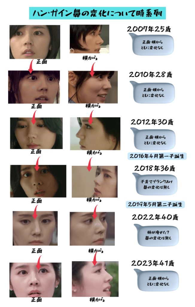 韓国女優ハン・ガインの鼻の変化について検証画像
以下全12枚の画像

2007年25歳（正面からと横から）
2010年28歳（正面からと横から）
2012年30歳（正面からと横から）
2018年36歳（正面からと横から）
2022年40歳（正面からと横から）
2023年41歳（正面からと横から）

