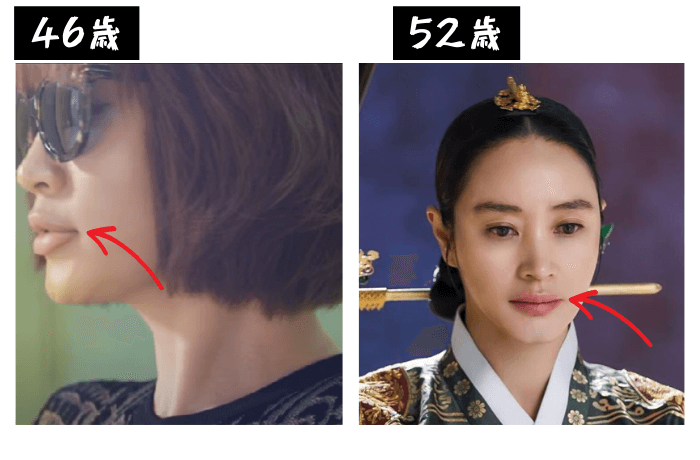 韓国女優キム・ヘス唇の変化の検証画像
46歳（左）写真
52歳（右）写真
唇の部分に矢印あり
どちらもぽってりと膨れた唇