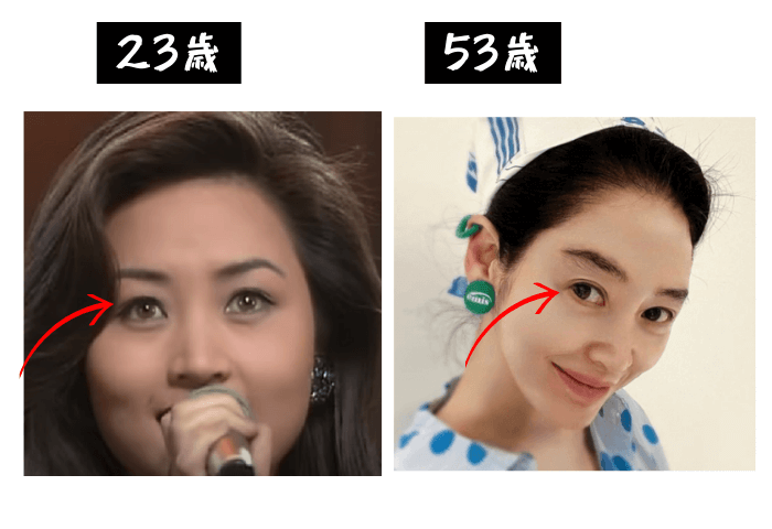 韓国女優キム・ヘス目周りの変化の検証画像
23歳（左）写真
53歳（右）写真
目の部分に矢印あり
明らかにまぶたのたるみが無くなっている