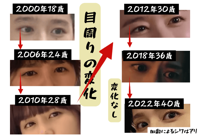 韓国女優ハン・ガインの目周りの変化について検証画像
以下全6枚の画像

2000年18歳
2006年24歳
2010年28歳
2012年30歳
2018年36歳
2022年40歳