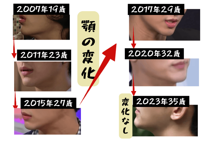韓国俳優キム・スヒョンの顎の変化について検証画像
以下全6枚の画像

2007年19歳
2011年23歳
2015年27歳
2017年29歳
2020年32歳
2023年35歳