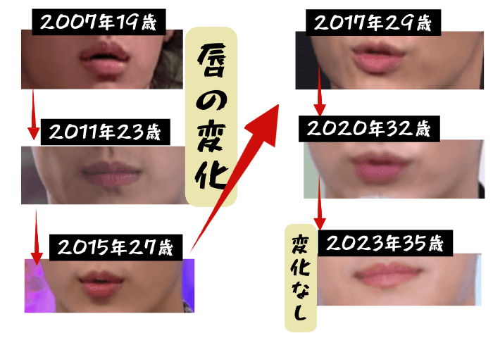 韓国俳優キム・スヒョンの唇の変化について検証画像
以下全6枚の画像

2007年19歳
2011年23歳
2015年27歳
2017年29歳
2020年32歳
2023年35歳