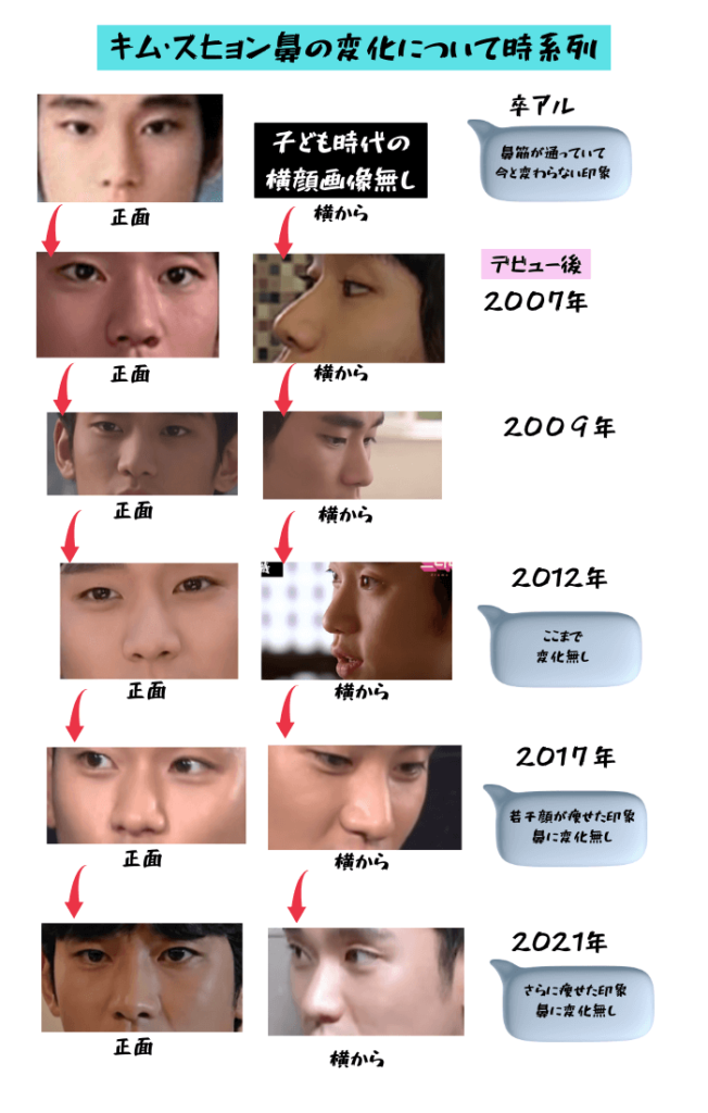 韓国俳優キム・スヒョンの鼻の変化について検証画像
以下全11枚の画像

卒アル（正面）
2007年（正面からと横から）
2009年（正面からと横から）
2012年（正面からと横から）
2007年（正面からと横から）
2021年（正面からと横から）