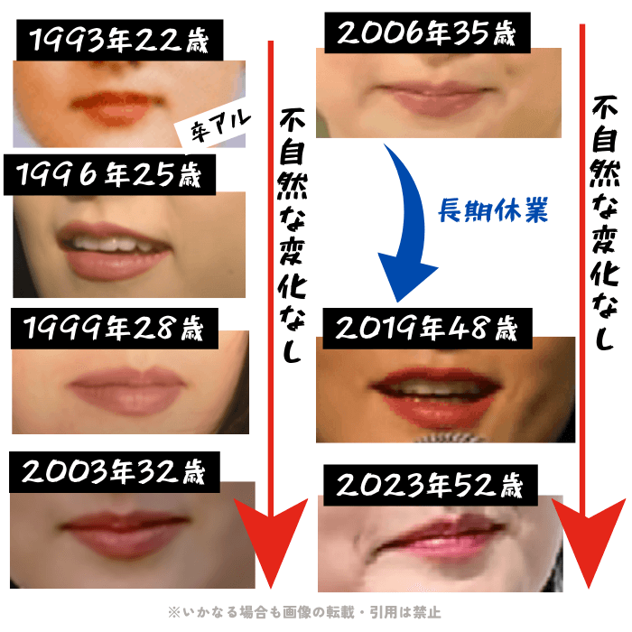 韓国女優イ・ヨンエの唇の変化について検証画像
以下7枚の画像

1993年22歳（大学卒業アルバム）
1996年25歳
1999年28歳
2003年32歳
2006年35歳
2019年48歳
2023年52歳

唇に不自然な変化が無いことがわかる