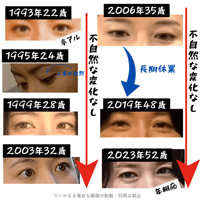 韓国女優イ・ヨンエの目周りの変化について検証画像
以下7枚の画像

1993年22歳（大学卒業アルバム）
1995年24歳
1999年28歳
2003年32歳
2006年35歳
2019年48歳
2023年52歳

目周りに不自然な変化が無いことがわかる