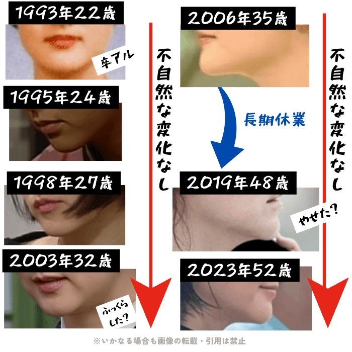 韓国女優イ・ヨンエの顎の変化について検証画像
以下7枚の画像

1993年22歳（大学卒業アルバム）
1995年24歳
1998年27歳
2003年32歳
2006年35歳
2019年48歳
2023年52歳

2003年32歳の画像は二重顎になっており、少しふっくらした様子。
長期休業明けの2019年48歳の画像は顎がシャープになっており痩せた印象がある。
時系列画像から、顎に不自然な変化が無いことがわかる。