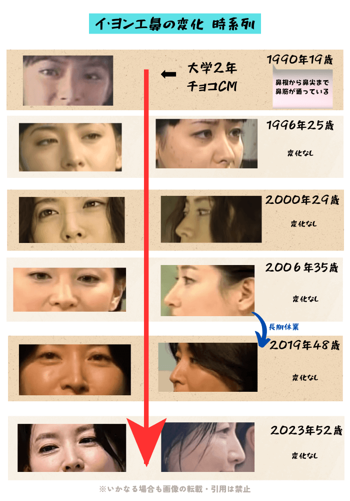 韓国女優イ・ヨンエの鼻の変化について時系列検証画像
以下11枚の画像

1990年19歳（鼻の正面の画像）
1996年25歳（鼻の正面・横からの画像）
2000年29歳（鼻の正面・横からの画像）
2006年35歳（鼻の正面・横からの画像）
2019年48歳（鼻の正面・横からの画像）
2023年52歳（鼻の正面・横からの画像）
鼻の形状に不自然な変化が無いことがわかる。