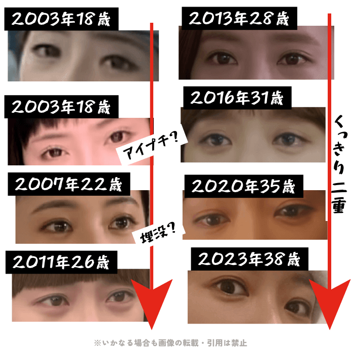 韓国女優ファン・ジョンウムの目周りの変化について検証画像
以下8枚の画像

2003年18歳
2003年18歳（アイプチの可能性）
2007年22歳（埋没手術の可能性）
2011年26歳
2013年28歳
2016年31歳
2020年35歳
2023年38歳

2007年以降はずっと「くっきり二重」に変化したままなことが確認できる。