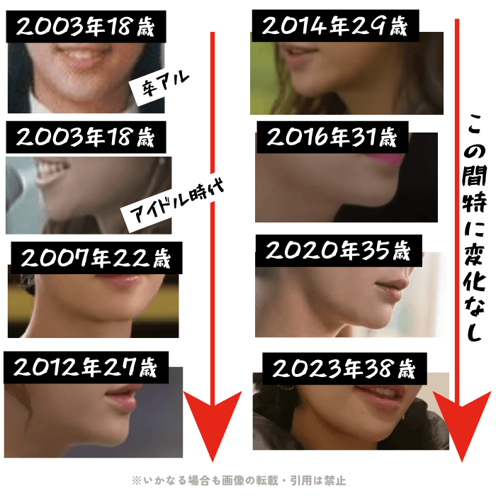 韓国女優ファン・ジョンウムの顎の変化について検証画像
以下8枚の画像

2003年18歳（卒業アルバム）
2003年18歳（アイドル時代）
2007年22歳
2012年27歳
2014年29歳
2016年31歳
2020年35歳
2023年38歳

顎の変化は特にみられないことが確認できる。