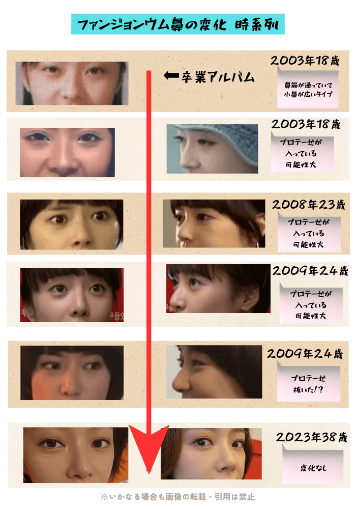 韓国女優ファン・ジョンウムの鼻の変化について検証画像
以下11枚の画像

2003年18歳（正面からのみ）
2003年18歳（正面からと横から）
2008年23歳（正面からと横から）
2009年24歳（正面からと横から）
2009年24歳（正面からと横から）
2023年38歳（正面からと横から）