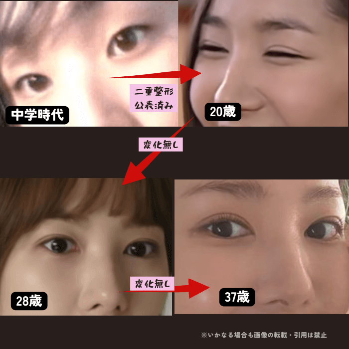 韓国女優パクミニョンの目の変化について時系列検証画像
以下4枚の画像

中学時代（左上画像）
20歳（右上画像）
29歳（左下画像）
37歳（右下画像）

中学時代と20歳の目の画像には明らかな違いがあり、一重まぶたが二重まぶたに変化している
その後は37歳現在まで同じ二重幅で変化は無い