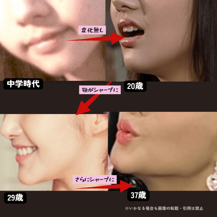 韓国女優パクミニョンの顎の変化について時系列検証画像
以下4枚の画像

中学時代（左上画像）
20歳（右上画像）
29歳（左下画像）
37歳（右下画像）

中学時代から37歳まで徐々に顎がシャープになっている。
