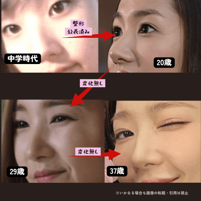 韓国女優パクミニョンの鼻の変化について時系列検証画像
以下4枚の画像

中学時代（左上画像）
20歳（右上画像）
29歳（左下画像）
37歳（右下画像）

中学時代と20歳の鼻の画像には明らかな違いがあり、20歳の鼻が高くなっている

それ以降は37歳現在まで鼻の形に変化が無い